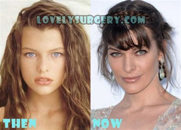 Milla Jovovich Plastic Surgery Before and After
